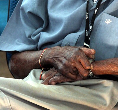Imagem mostra as mãos de um senhor idoso, com os dedos afetados pela hanseníase