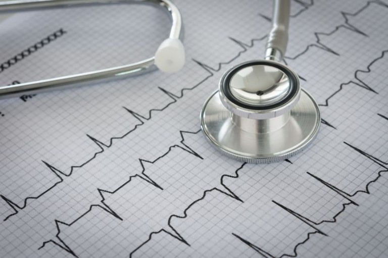 foto mostra um resultado de eletrocardiograma e um estetoscópio por cima