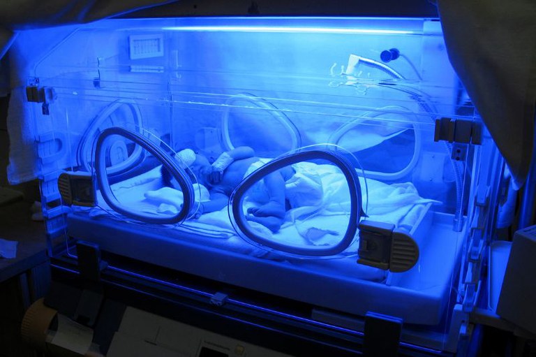 Recém-nascido de fralda e proteção nos olhos deitado sob luz azul intensa no interior de uma incubadora hospitalar transparente.