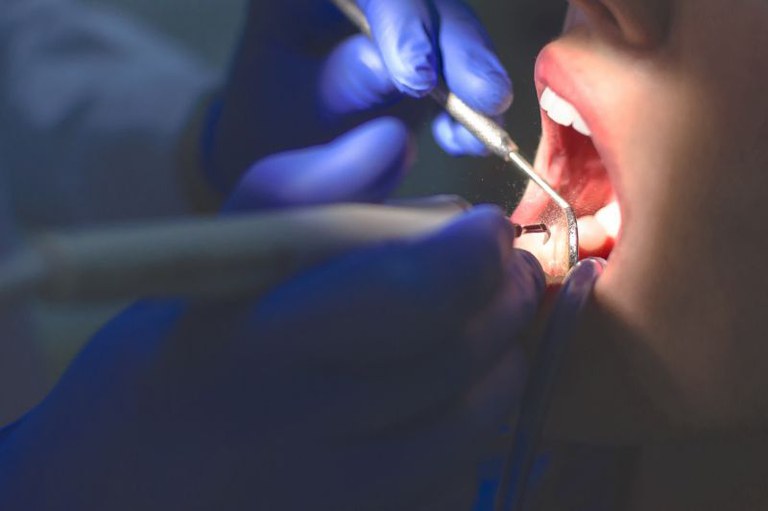 Foto mostra em detalhe um dentista trabalhando nos dentes de uma paciente