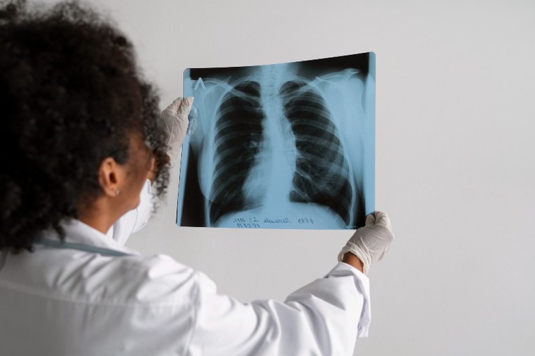 Imagem ilustrativa de um médico checando uma radiografia de um paciente com tuberculose.