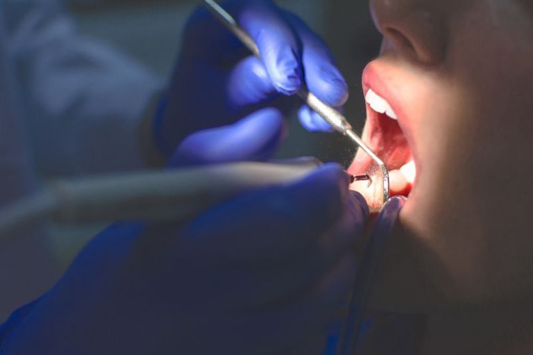 Foto mostra em detalhe um dentista olhando os dentes de um paciente que está com a boca aberta