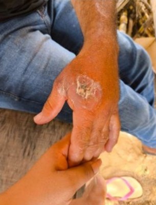 MPF-ACP-contaminacao-indigenas-meio-ambiente-Seringueiras-RO-Ilustracao-noticia-03-EDITADO.jpg