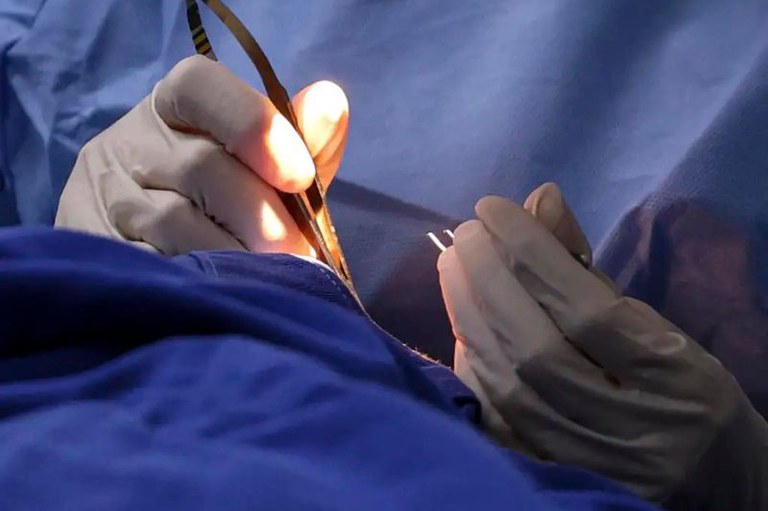 Foto em detalhe de um médico realizando uma cirurgia